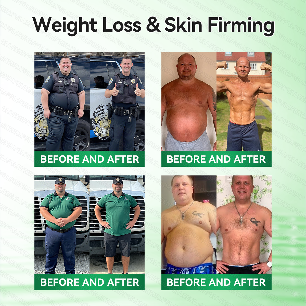 🇨🇦𝑶𝒇𝒇𝒊𝒄𝒊𝒂𝒍 𝑺𝒕𝒐𝒓𝒆  |🍀🫧𝐆𝑳𝑶𝗥𝗘𝗡𝘿𝘼® 𝙈𝒐𝒓𝒊𝒏𝒈𝗮 · 𝗕𝗲𝗿𝗯𝐞𝐫𝐢𝐧𝙚 × 𝙉𝑨𝑫+ 𝟏𝟎-𝙞𝙣-𝟏 𝘼𝒅𝒗𝒂𝒏𝒄𝒆𝐝 𝐍𝐚𝐧𝙤 𝙈𝙞𝙘𝙧𝙤𝙣𝒆𝒆𝒅𝒍𝐞 𝐏𝐚𝐭𝙘𝙝(𝐉𝐮𝐬𝐭 𝐨𝐧𝐜𝐞 𝐚 𝐝𝐚𝐲, 𝐯𝐢𝐬𝐢𝐛𝐥𝐞 𝐜𝐡𝐚𝐧𝐠𝐞𝐬 𝐢𝐧 𝟕 𝐝𝐚𝐲𝐬） ✅ 𝐅𝐨𝐫 𝐨𝐛𝐞𝐬𝐢𝐭𝐲, 🅛🅞🅞🅢🅔 🅢🅚🅘🅝,𝐝𝐢𝐚𝐛𝐞𝐭𝐞𝐬, 𝐬𝐥𝐞𝐞𝐩 𝐚𝐩𝐧𝐞𝐚, 𝐣𝐨𝐢𝐧𝐭 𝐢𝐬𝐬𝐮𝐞𝐬, 𝐚𝐧𝐝 𝐦𝐨𝐫𝐞